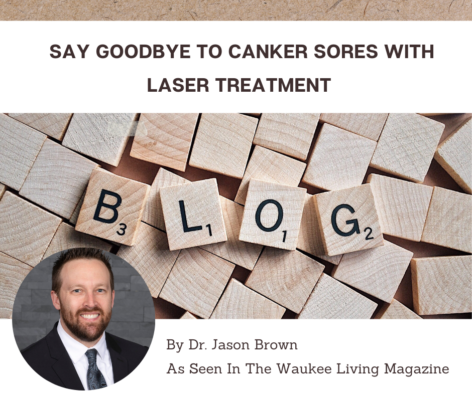Say Goodbye to Canker Sores with Laser Treatment